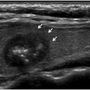 thyroid_ultrasonography_0010.png