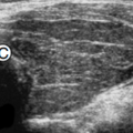 thyroid_ultrasonography_4129.png