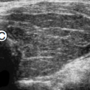 thyroid_ultrasonography_4129.png