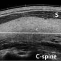 thyroid_ultrasonography_5504.png