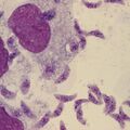 toxoplasma.jpg