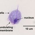 trichomonas.jpg