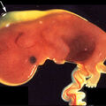 trisomy_21_sub_fluid_photo.jpg