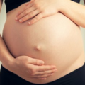 umbilical_hernia-095900.png