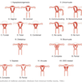 uterine_anomalies_0627113400.png