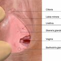 vulva_glands.jpg