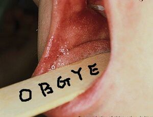 koplik spot（bluish-white lesion , salt appearance）
