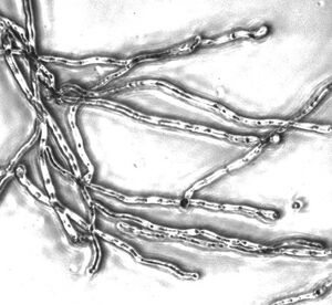 candida_20albicans.jpg